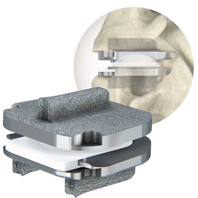 Centinel Spine® Extends Leadership in Total Disc Replacement through ...