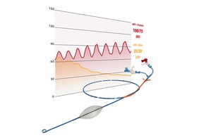 New FORCE Study on Partial REBOA in Battlefield Conditions Aims to Improve Combat Casualty Care