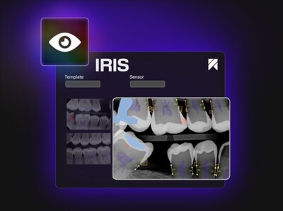 IRIS makes AI analysis an essential step of dental diagnosis and education.