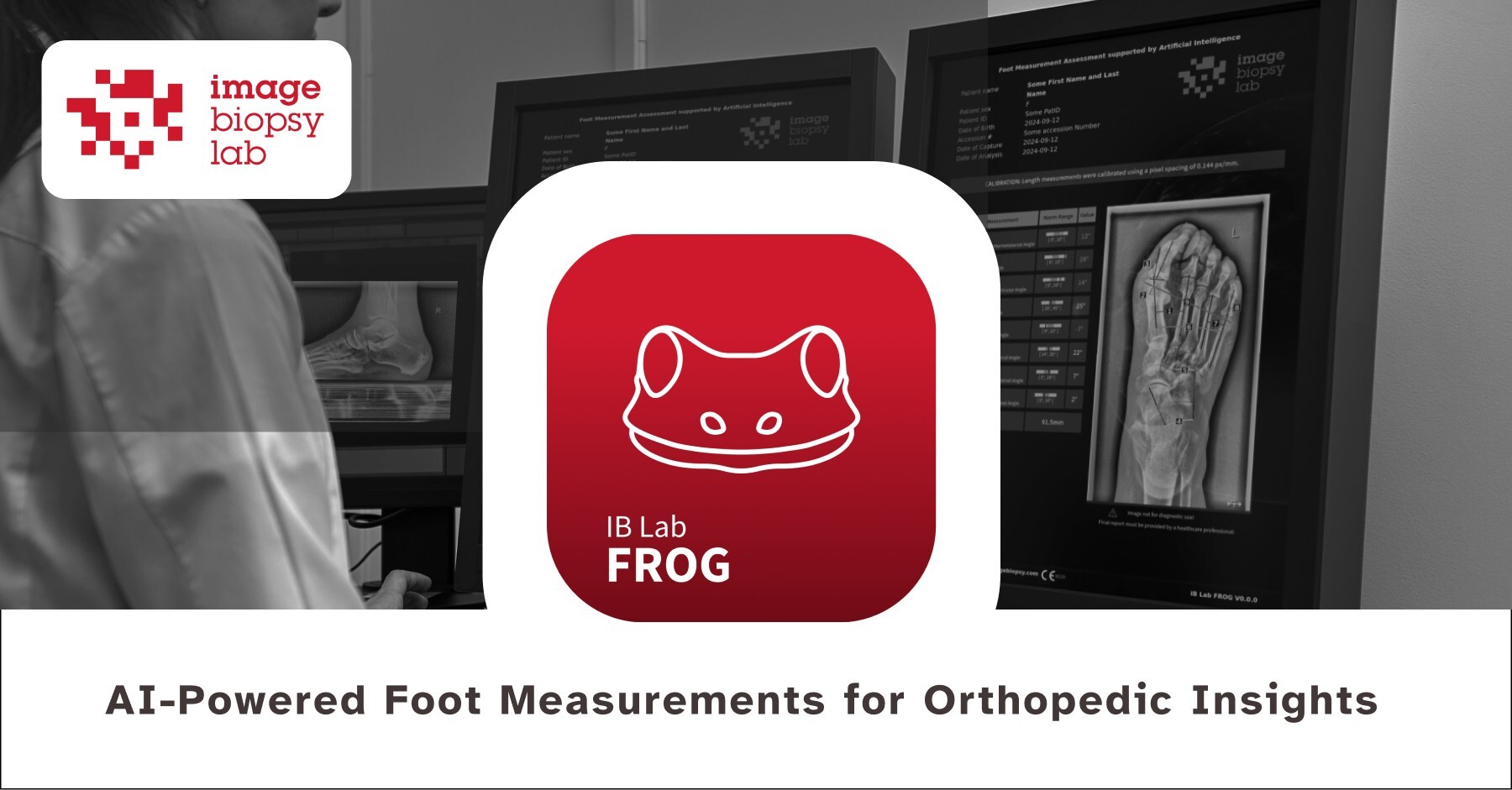 ImageBiopsy Lab hat IB Lab FROG released: KI-gestützte Fußwinkelmessungen für orthopädische Diagnostik