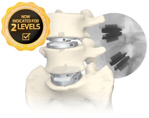 Coverage Expansion Continues for One- and Two-level Lumbar Total Disc Replacement as Top Commercial Payers in Mid-Atlantic Region Extend Positive Coverage for Centinel Spine's prodisc® L