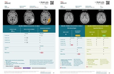 Figure 2: Example reports of icobrain aria