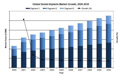 Global Dental Implants Market Growth, 2020-2030 (CNW Group/iData Research Inc.)