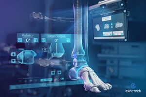 Exactech Announces First Surgeries with the World's First Surgical Navigation for Total Ankle Replacement
