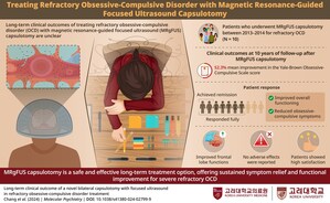 Korea University Study Highlights a Novel Non-Invasive Brain Surgery for Lasting Relief from Severe Obsessive-Compulsive Disorder