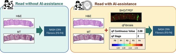 Figure 1. Read without AI-assistance vs. read with AI-assistance [2]