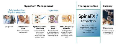 SpinaFX's not yet approved treatment Triojection® for contained herniated discs - fills the therapeutic gap between conservative care and surgery (CNW Group/SpinaFX)