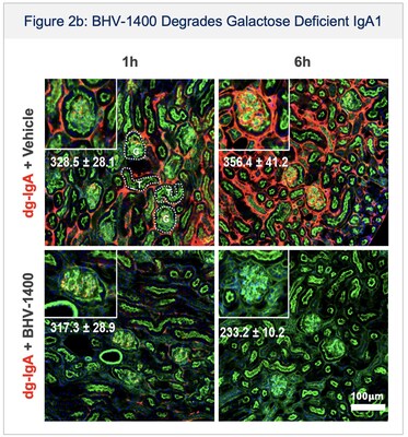 Figure 2: (B) BHV-1400 degrades galactose deficient IgA1 (red) in vivo in preclinical models. With BHV-1400 administration compared to vehicle administration, galactose deficient IgA1 clears from the renal glomerulus (inset) over hours. BHV-1400 was designed with precision to remove the pathogenic driver of IgA nephropathy and preserve components of the immune system crucial to fighting infections, such as meningitis.