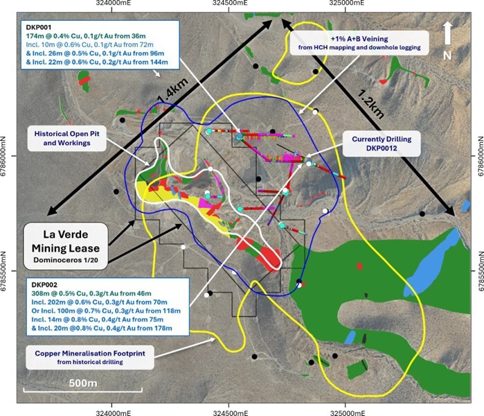 Figure 2. Plan view map of the La Verde porphyry system showing the significant intercepts of DKP001 and DKP002 compared to historic drill collars, open pit extent (white), in pit geological mapping, +1% A+B vein footprint from mapping and drillholes (blue) and logged copper mineralisation footprint from historic logging (yellow). (CNW Group/Hot Chili Limited) Figure 2. Plan view map of the La Verde porphyry system showing the significant intercepts of DKP001 and DKP002 compared to historic drill collars, open pit extent (white), in pit geological mapping, +1% A+B vein footprint from mapping and drillholes (blue) and logged copper mineralisation footprint from historic logging (yellow). (CNW Group/Hot Chili Limited)