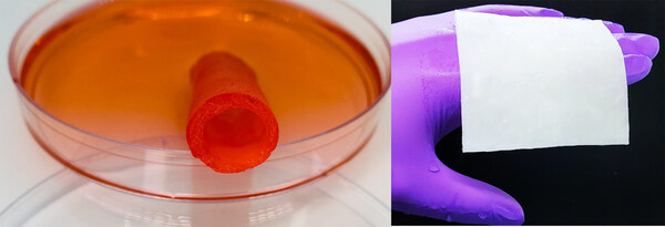 Tissue engineered blood vessel and dermal graft made from human collagen