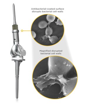 Onkos Surgical® Successfully Completes Groundbreaking, First-in-Human Cases Using NanoCept™ Antibacterial Technology