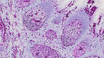 VENTANA® Kappa and Lambda Dual ISH mRNA Probe Cocktail