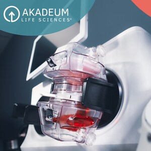 Akadeum's Paradigm-Changing Cell Separation Technology to be Showcased at Advanced Therapies Week 2025