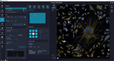 MetaXpress Acquire Software streamlines complex workflows so new users can get started quickly and advanced users can leverage its flexibility to create optimized protocols.