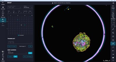 IN Carta Image Analysis Software, powered by machine learning, enables uses to train custom deep learning algorithms in just a few clicks.