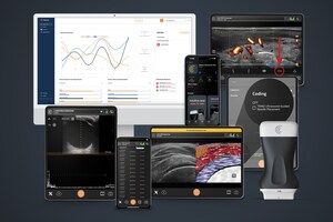 Clarius Announces New Ultrasound Software Innovations to Enhance Efficiency and User Experience