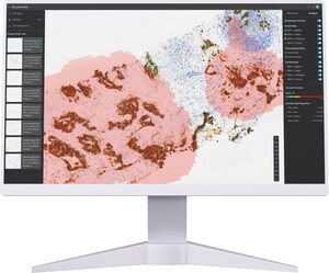 Lunit AI Enhances Precision in Predicting Outcomes for HER2-Targeted Therapy in Metastatic Colorectal Cancer - new study published in JCO Precision Oncology