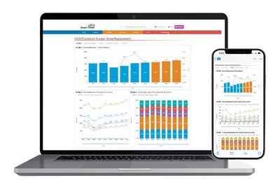 SmartTRAK's New OUS Procedure Tracker Tool