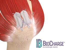 Atreon Orthopedics Announces FDA 510(k) Clearance and Full Market Launch of BioCharge® Autobiologic Matrix for Rotator Cuff Repair