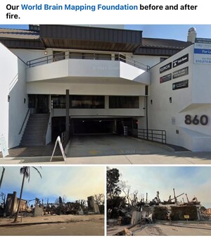 The World Brain Mapping Foundation Rises from the Ashes of the Pacific Palisades Fires to Host the Prestigious Gala and Convention in Los Angeles on the Eve of the Oscars The World Brain Mapping Foundation Rises from the Ashes of the Pacific Palisades Fires to Host the Prestigious Gala and Convention in Los Angeles on the Eve of the Oscars