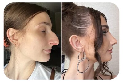 Unable to view the image, Please provide a valid URL.