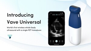 Vave Health Introduces World's First Wireless, Handheld, Whole-Body Ultrasound with a Single PZT Transducer