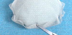 BD Announces Milestone in Clinical Trial for Use of Bioabsorbable GalaFLEX LITE™ Scaffold in Breast Implant Revision Surgery