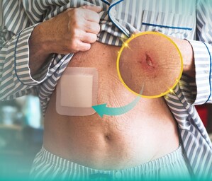 Wounds hard to heal? Troubled by dressing changes? Dimora, Amazon's 3-year top brand, shows you the way.