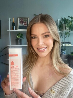 BIO-OIL® LAUNCHES "SCAR STORIES" CAMPAIGN WITH ARIANA MADIX TO HONOR THE JOURNEYS BEHIND EVERY SCAR