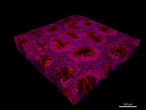JelloX Research Collaborations Further Demonstrate Promise of 3D Pathology JelloX Research Collaborations Further Demonstrate Promise of 3D Pathology