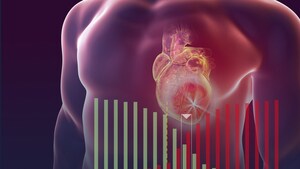 Ultromics Introduces AI-Powered Probability Scoring on EchoGo® Heart Failure for Enhanced HFpEF Diagnosis