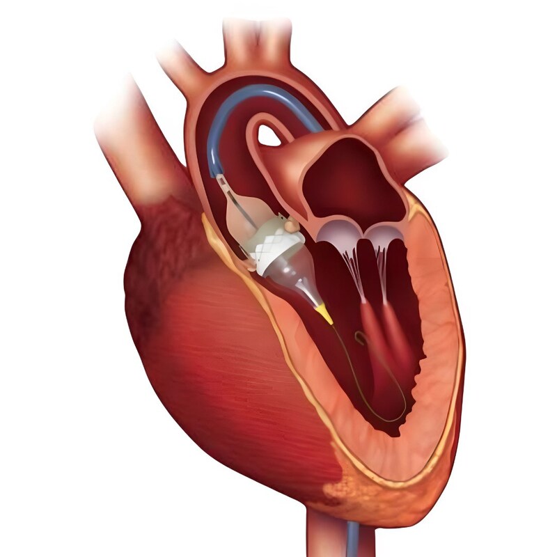 Unable to view the image, Please provide a valid URL.