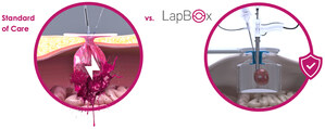 Ark Surgical Secures FDA Clearance for LapBox® POWER, First Dual-Wall System for Contained Morcellation