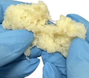 Xtant Medical Launches Trivium™ Advanced Bone Graft for Superior Performance
