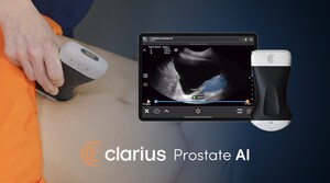 FDA Clears New Clarius Prostate AI To Help Physicians Assess and Diagnose Common Urologic Conditions in Minutes
