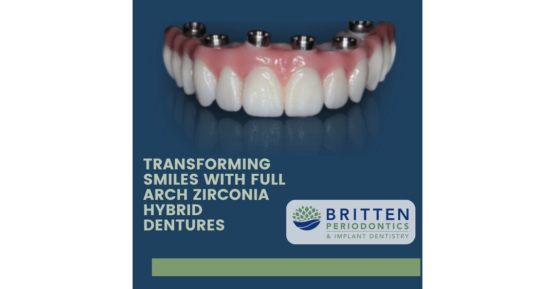 Clearwater Residents: Experience the Future of Dental Implants