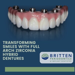 Clearwater Residents: Experience the Future of Dental Implants