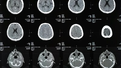 Unable to view the image, Please provide a valid URL.