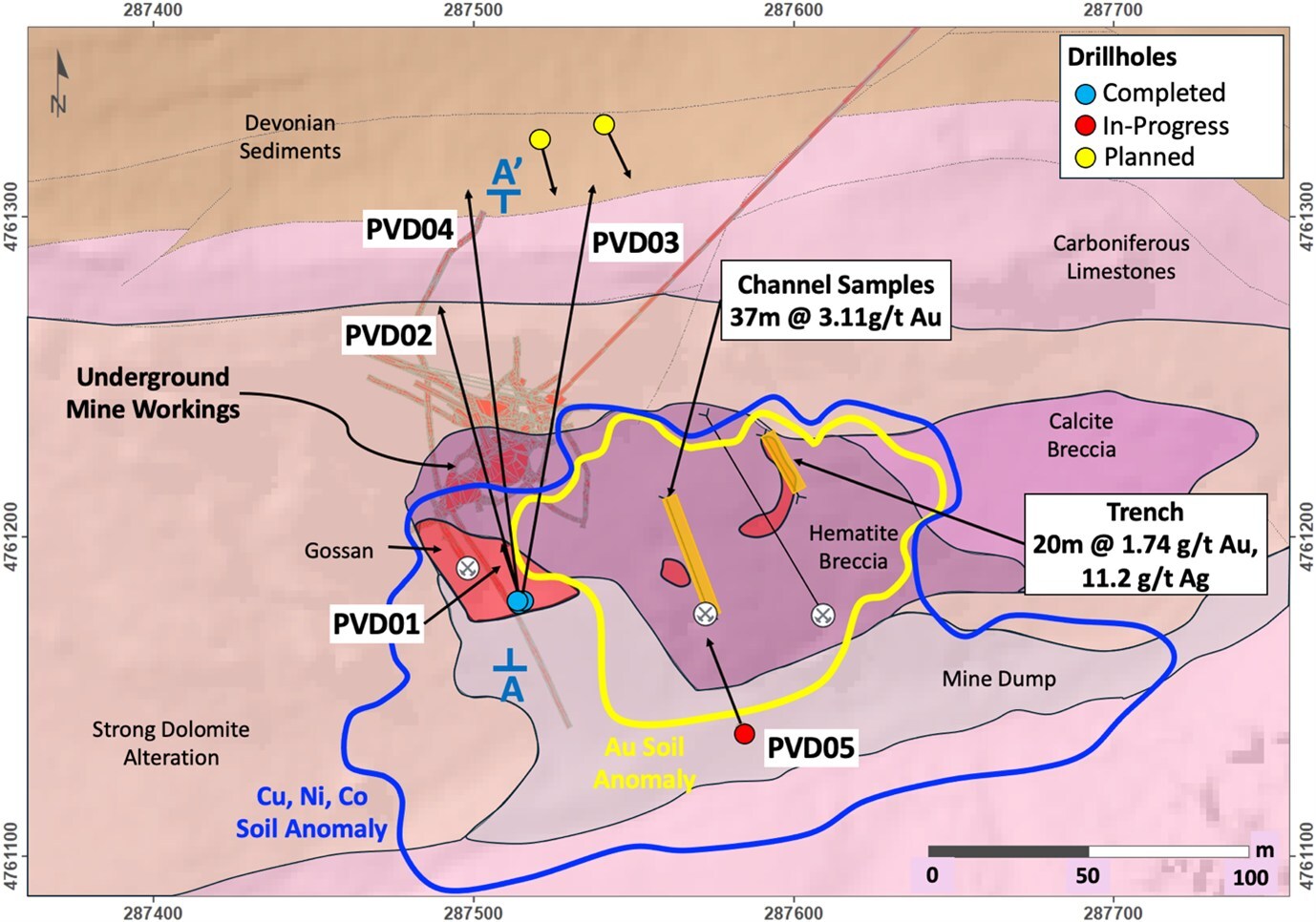 Figure 1 – Providencia Target - geology map showing the historical mine workings, drillholes and cross-section location (A-A’ - Figure 2). (CNW Group/Pan Global Resources Inc.) Figure 1 – Providencia Target - geology map showing the historical mine workings, drillholes and cross-section location (A-A’ - Figure 2). (CNW Group/Pan Global Resources Inc.)
