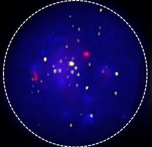 Cell with a high-copy transgenic integration profile, where each yellow signal represents an integration event in a diploid genome (indicated by the two red signals) Cell with a high-copy transgenic integration profile, where each yellow signal represents an integration event in a diploid genome (indicated by the two red signals)