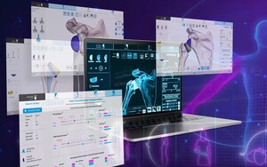 Exactech Launches Next-Generation Shoulder Planning App with Advanced Surgical Features