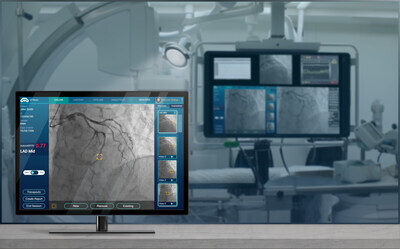 MedHub-AI Receives PMDA Approval in Japan for AutocathFFR®