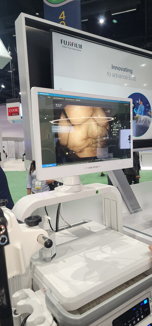 Cybernet's Medical Panel PC Showcased at DDW 2025 as Part of Fujifilm's Innovative Endoscopy Solution