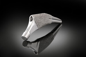 First Patient Treated with the Alteon® Short Tapered Wedge Total Hip Replacement