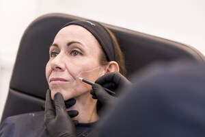 Flacidez facial? Descubra as últimas novidades em tratamentos para recuperar a firmeza da pele do rosto