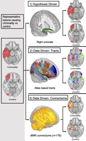Researchers applied multiple techniques to determine the brain connections associated with new onset criminal behavior. -image from Isaiah Kletenik, MD / Brigham and Women’s Hospital