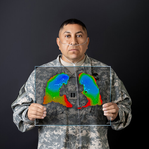 Veteran with biopsy-confirmed constrictive bronchiolitis, holds XV LVAS® color-mapped image of his lungs.