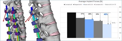 Figure 2: Average force magnitude sustained by the two proximal pedicle screws under flexion for the 5 instrumentation scenarios.