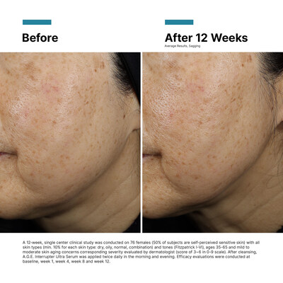 Courtesy of SkinCeuticals