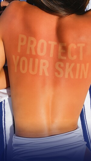 LA ROCHE-POSAY AND GLOBAL SKIN HEALTH EXPERTS UNITE TO WARN ABOUT LONG TERM CONSEQUENCES OF DANGEROUS 'BURN LINES' SOCIAL MEDIA TREND